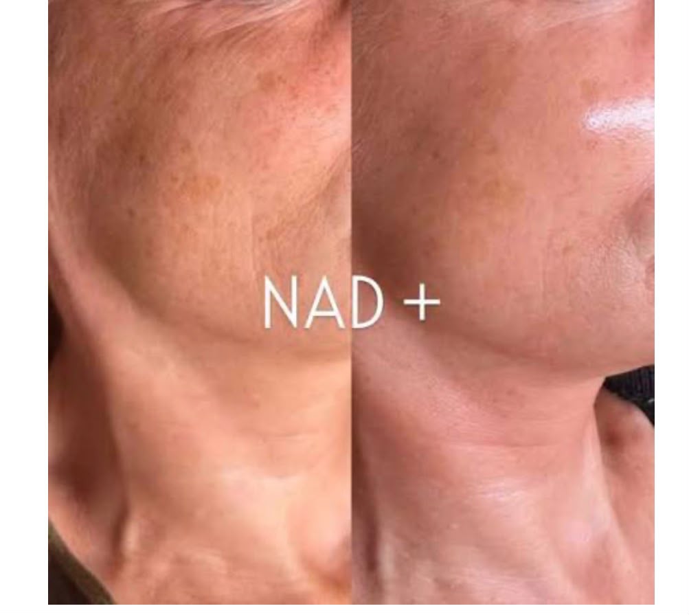 NAD · Pack 3 sesiones